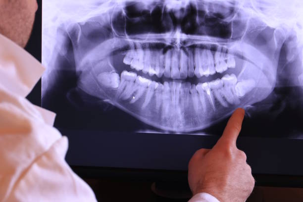 Best Mobile Emergency Dentist in Bridgeport, WV