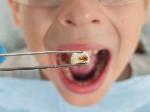Best Emergency Dental Services for Seniors in Bridgeport, WV