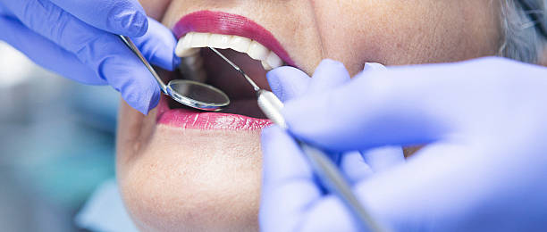 Best Emergency Dentist for Lost Fillings or Crowns in Bridgeport, WV