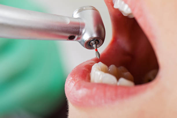 Best Emergency Dental Services for Seniors in Bridgeport, WV